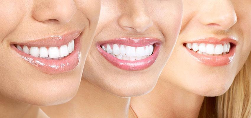 Come cambia la Vita con la Dentiera